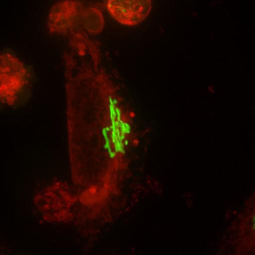 epithelial cell