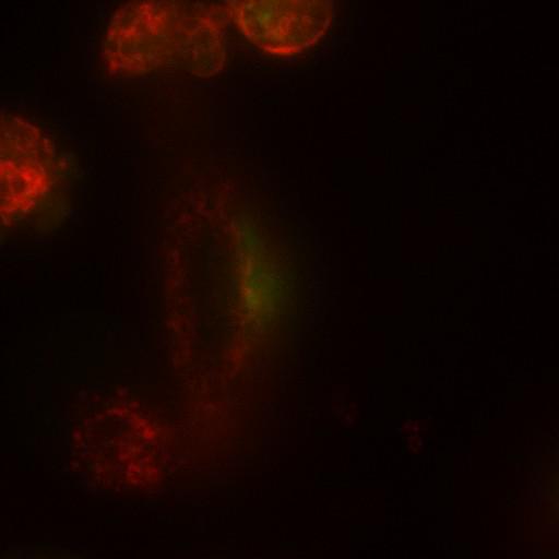 epithelial cell