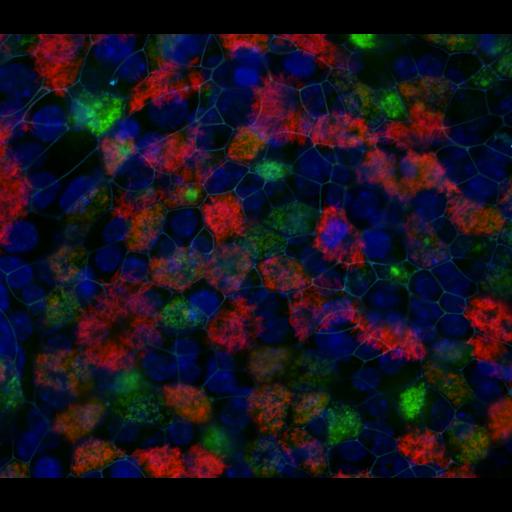 tracheal epithelial cell