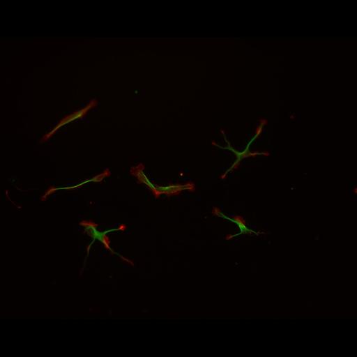 multipolar neuron