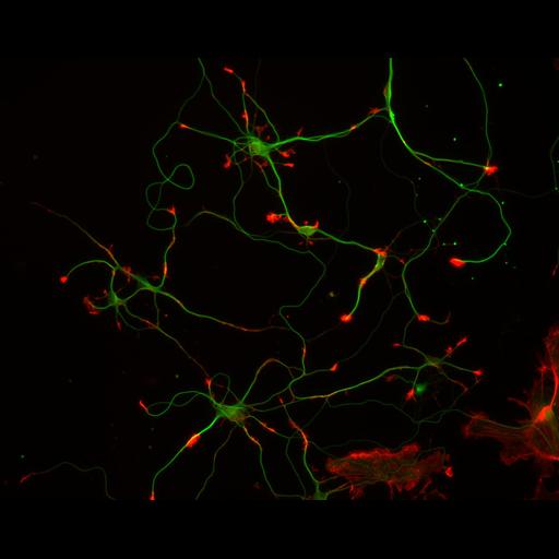 multipolar neuron