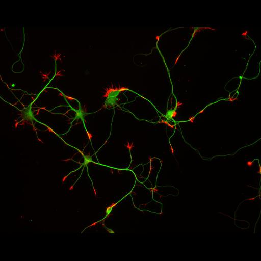 multipolar neuron