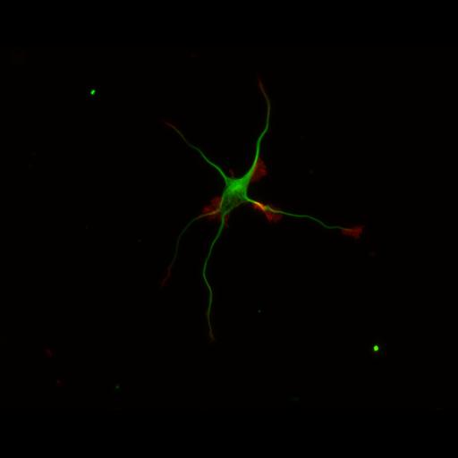 multipolar neuron