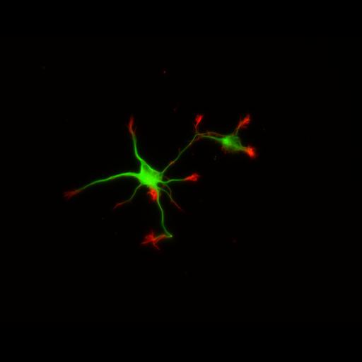 multipolar neuron