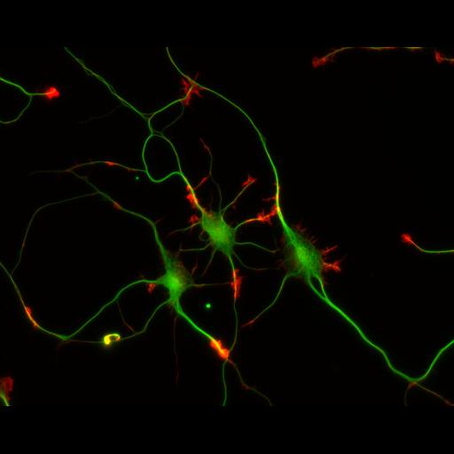 multipolar neuron