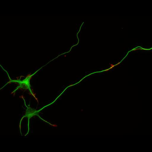 multipolar neuron