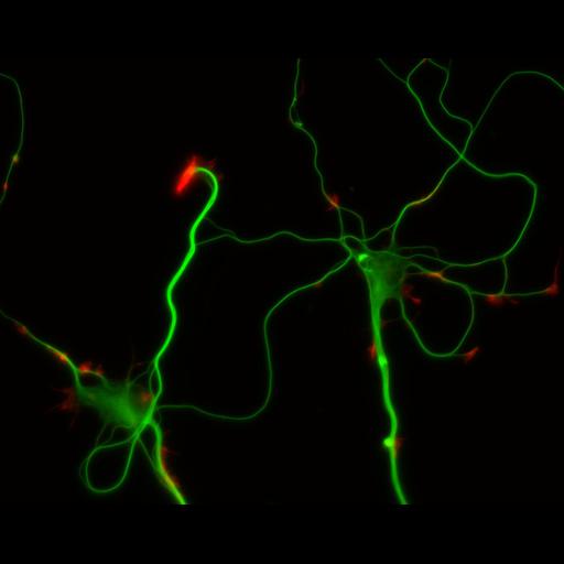 multipolar neuron