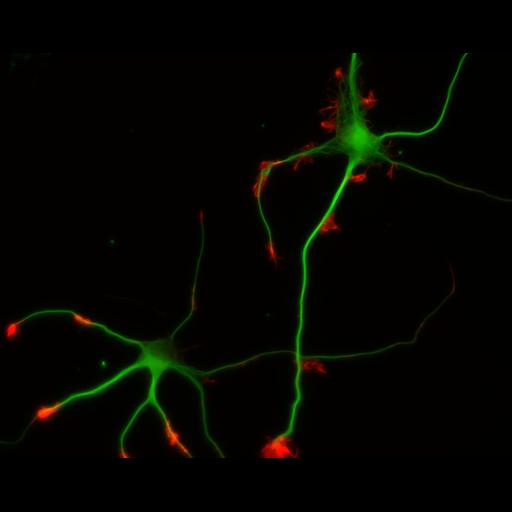 multipolar neuron