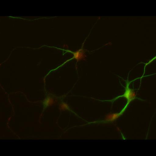 multipolar neuron