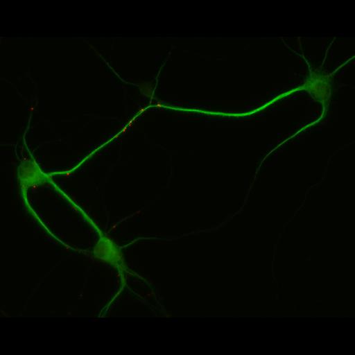 multipolar neuron