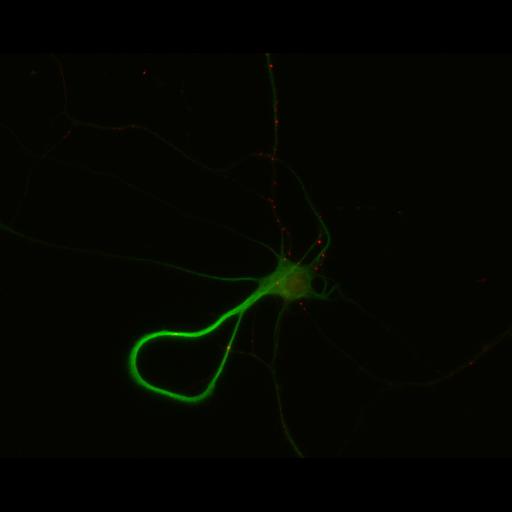 multipolar neuron