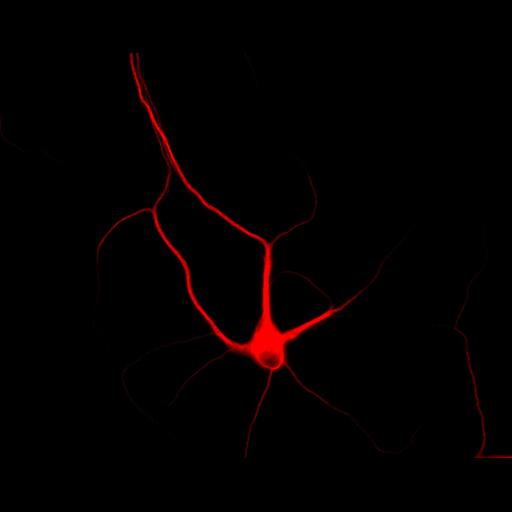 multipolar neuron