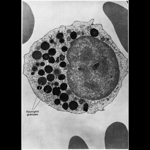 neutrophilic metamyelocyte