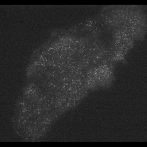 epithelial cell