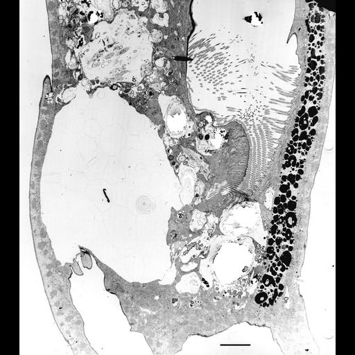 eukaryotic cell