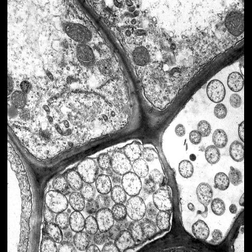 plant cell