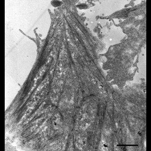 epithelial cell