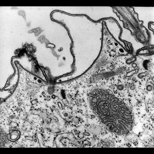 eukaryotic cell