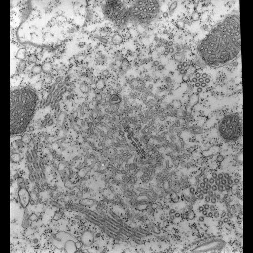 eukaryotic cell