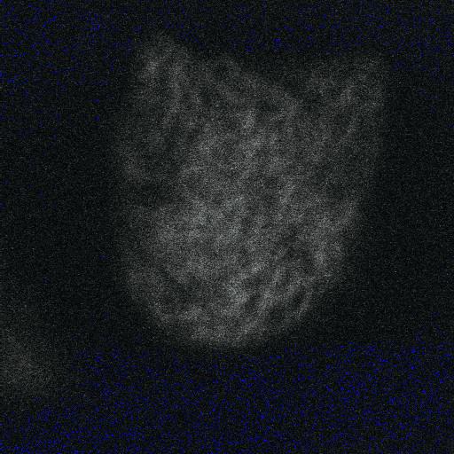 actin cytoskeleton