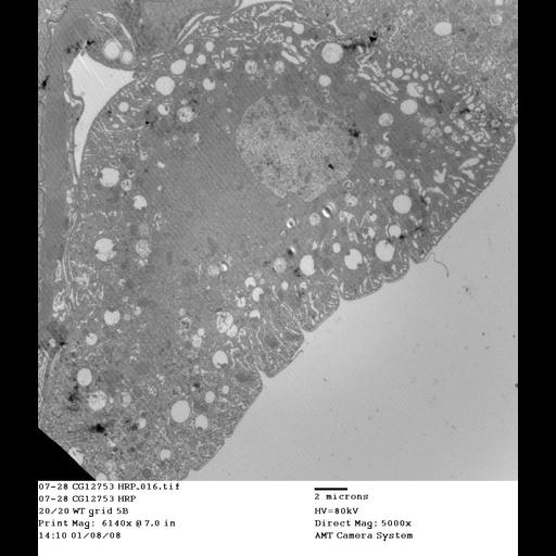 garland cell