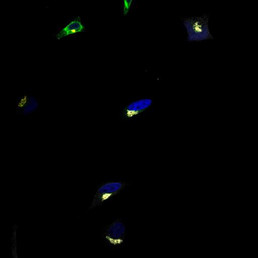 epithelial cell