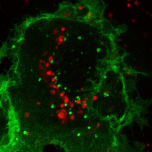 lysosome