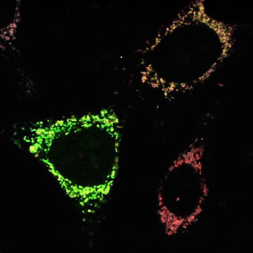 endothelial cell