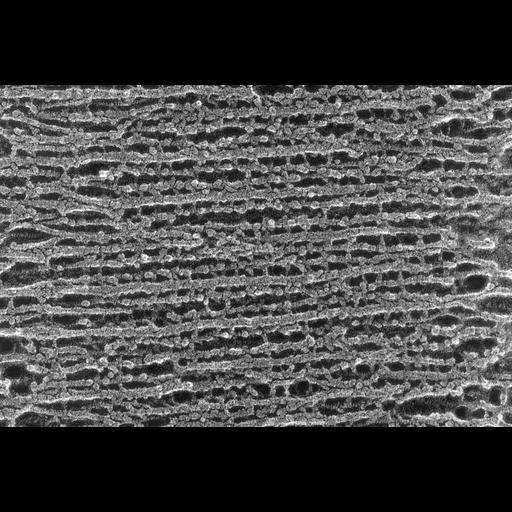 skeletal muscle cell