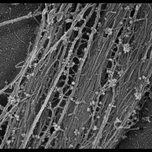 fibroblast