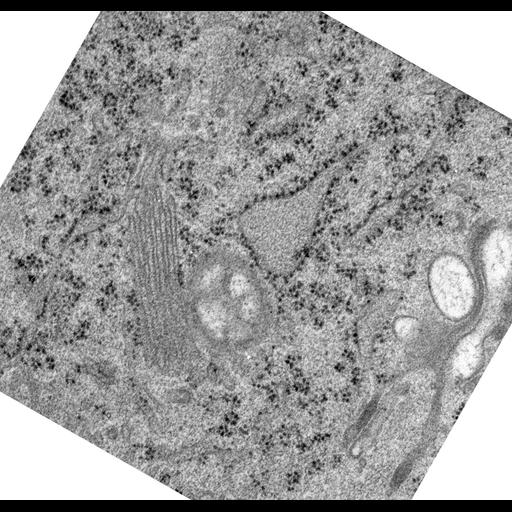 epithelial cell