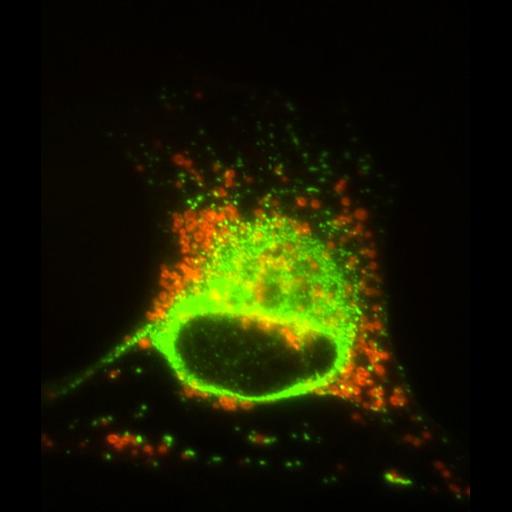 myelinating Schwann cell