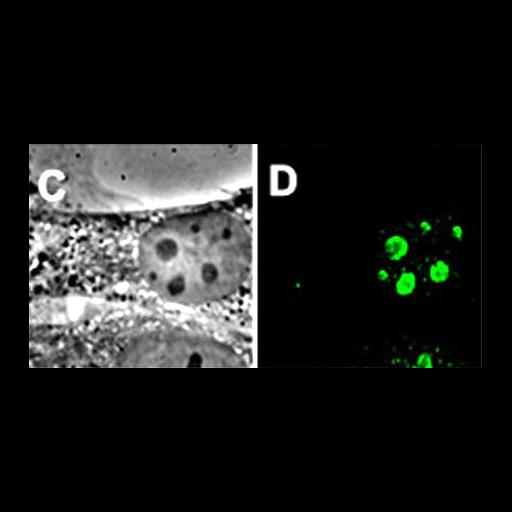 fibroblast