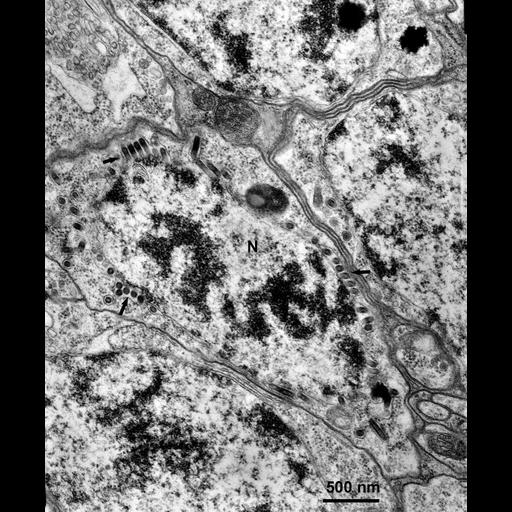 ganglion interneuron