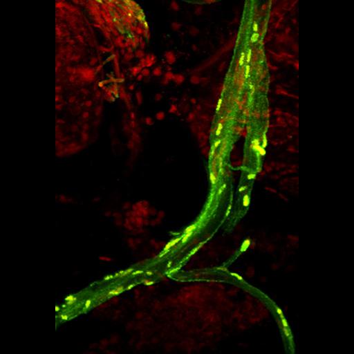 peripheral neuron