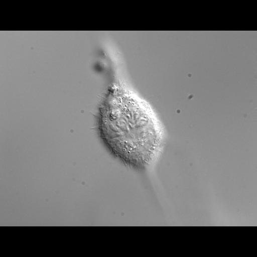 retinal pigment epithelium