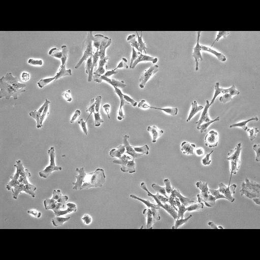 retinal pigment epithelium