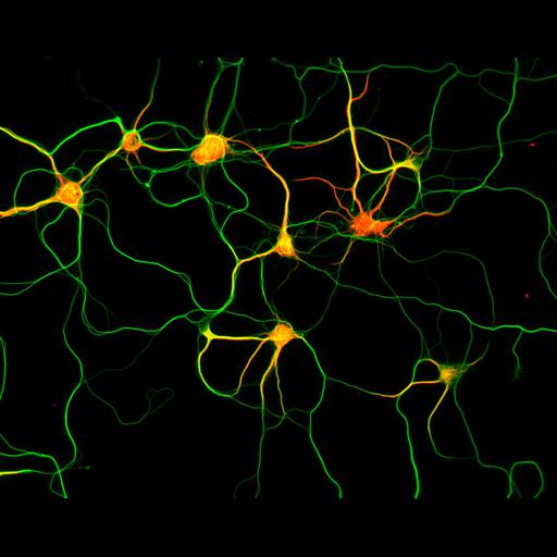 multipolar neuron