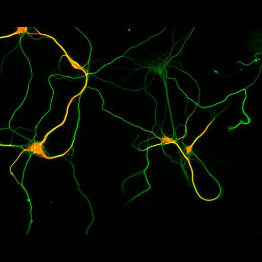 multipolar neuron