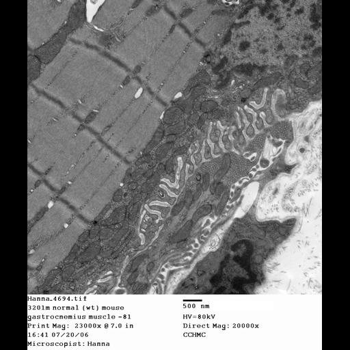 skeletal muscle cell