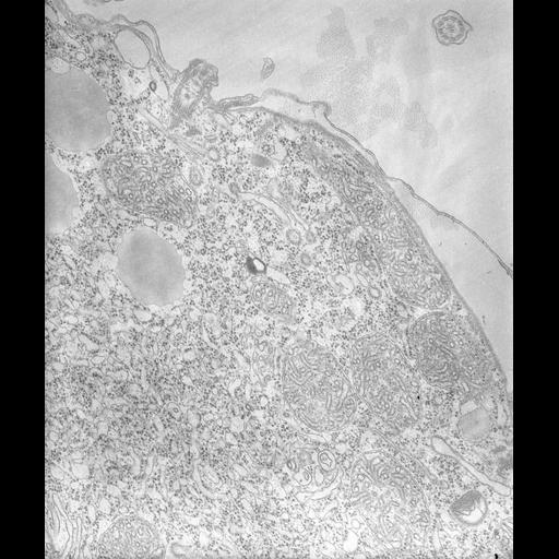 eukaryotic cell