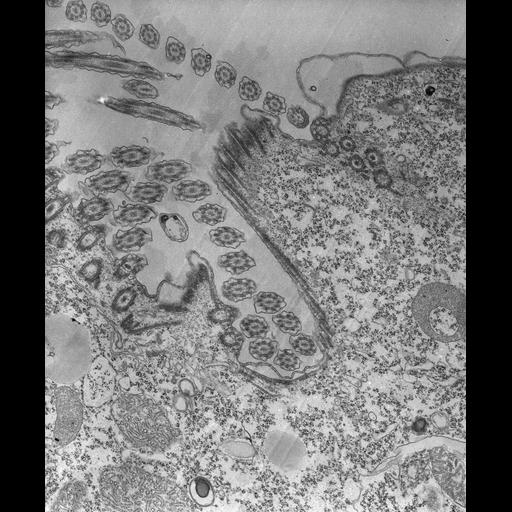 eukaryotic cell