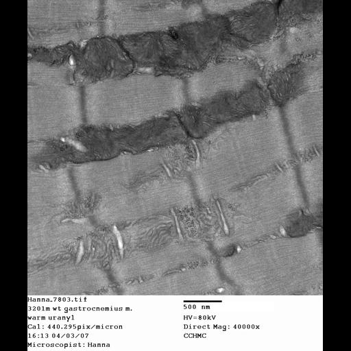 skeletal muscle cell