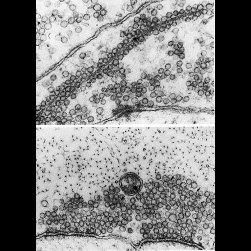 Mauthner neuron