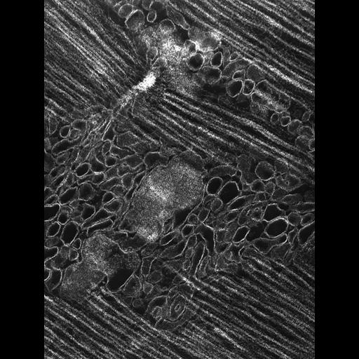 flight muscle cell