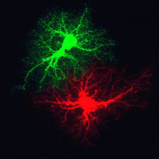 astrocyte