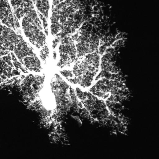 astrocyte