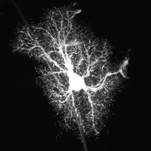 astrocyte