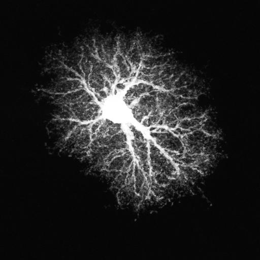 astrocyte