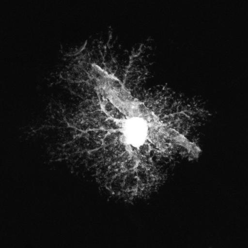 astrocyte